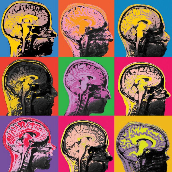 A mosaic of MRI images of the human brain.