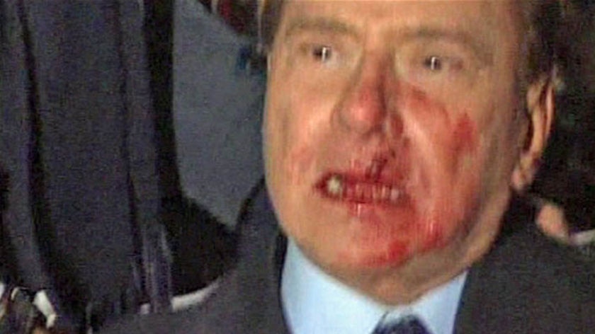 Bloodied: Silvio Berlusconi.