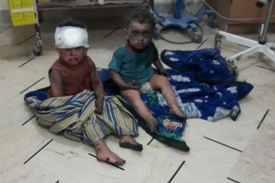 Two bloodied, injured children sit on the floor of an Aleppo, Syria hospital.