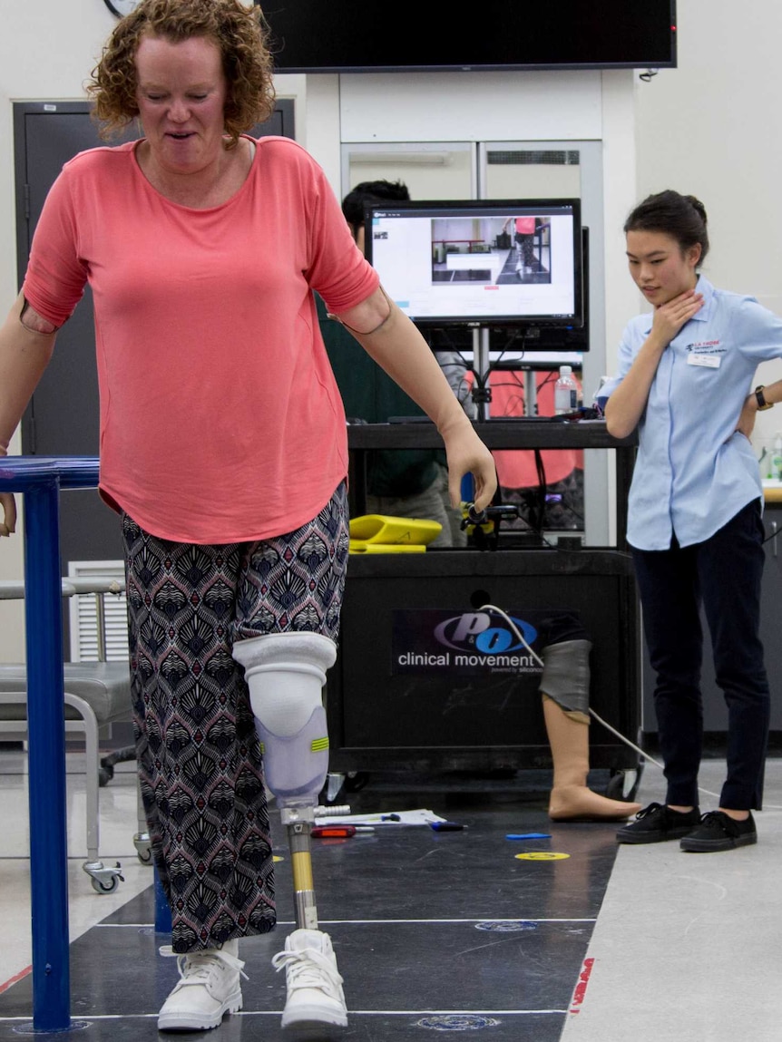 A woman walks on prosthetic legs down a black marked walkway in a white room. Younger woman in blue shirt watches attentively.