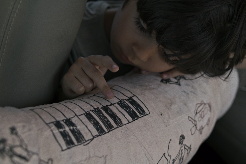 A young boy leaning on his fathers leg cast which has pen drawings on it, he touches a keyboard drawing. 