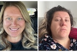 Before and after pictures of a woman with COVID.