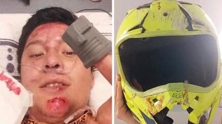 An image of a man laying in a hospital bed alongside a picture of his yellow motorbike helmet