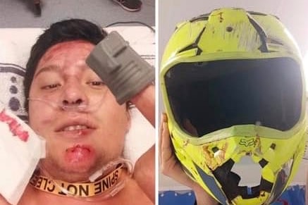 An image of a man laying in a hospital bed alongside a picture of his yellow motorbike helmet