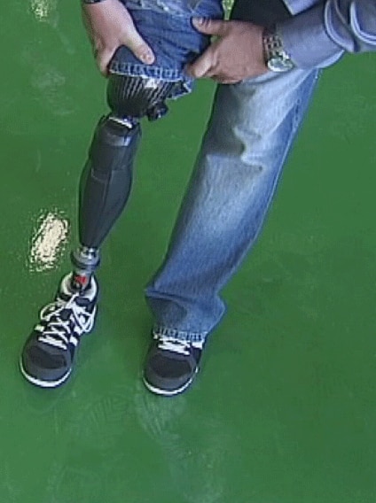 TV still of Paul Warren's artificial leg at Townsville recovery centre Wed May 7, 2014