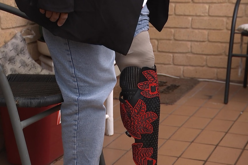 A waist-down image of Anthea Corbett and her prosthetic left leg