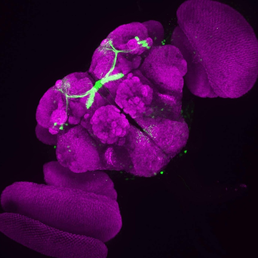 A fruit fly brain being studied by sleep researchers