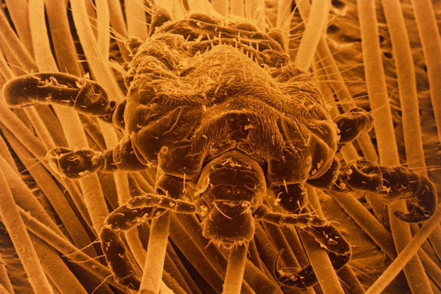Head louse up close under microscope