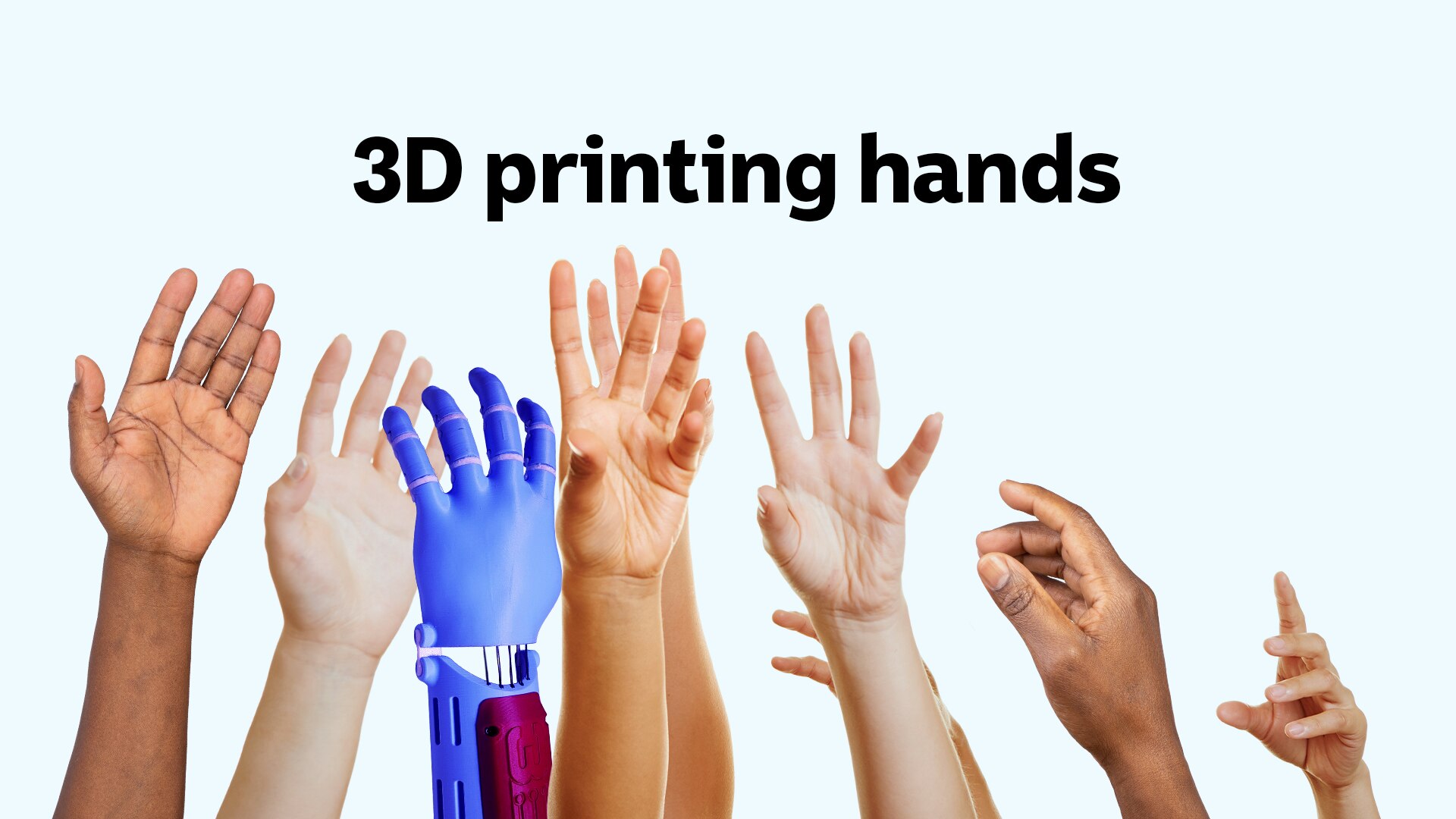 Eight hands reaching up and a 3D printed prosthetic hand amongst them.