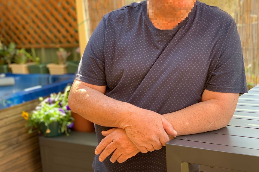 A man with a blurred face leans on a bench.