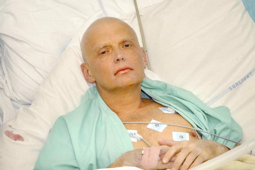 A man who has lost all his hair lies in a hospital bed. 