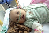 A baby lies in a hospital bed. His shirt is blood-stained and he his hooked up to an oxygen machine