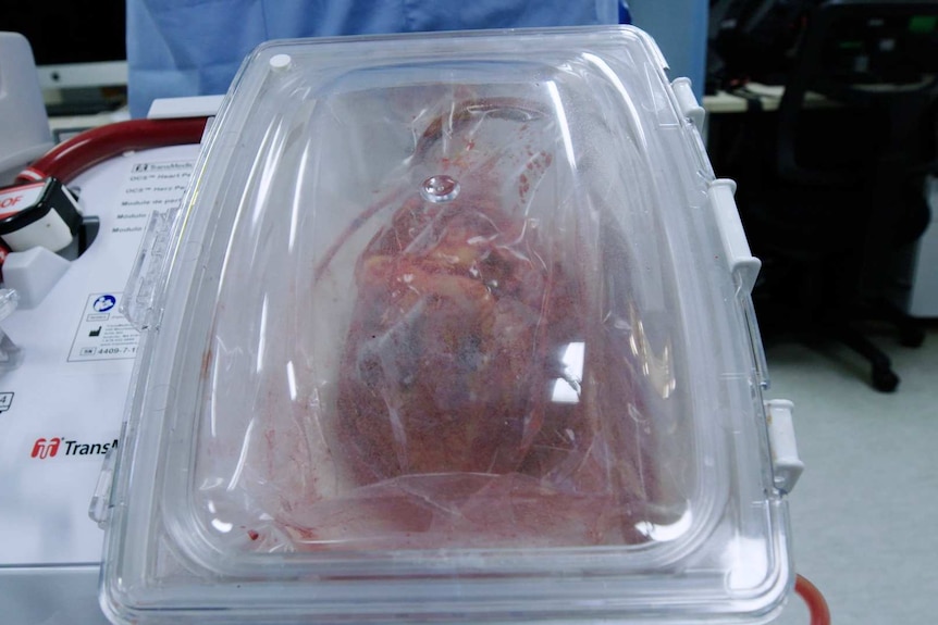 A heart in a clear plastic container hooked up to medical apparatus.