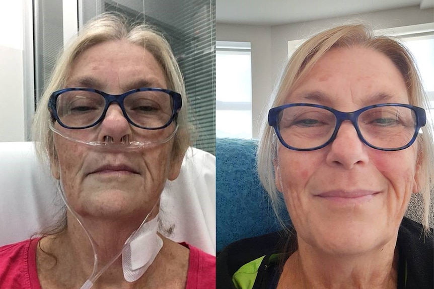 Two pictures of the same woman side by side wearing glasses. On the left she has nasal tubes and plaster on neck.