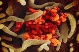 A microscopic image shows orange circular cells surrounded by long green cells.