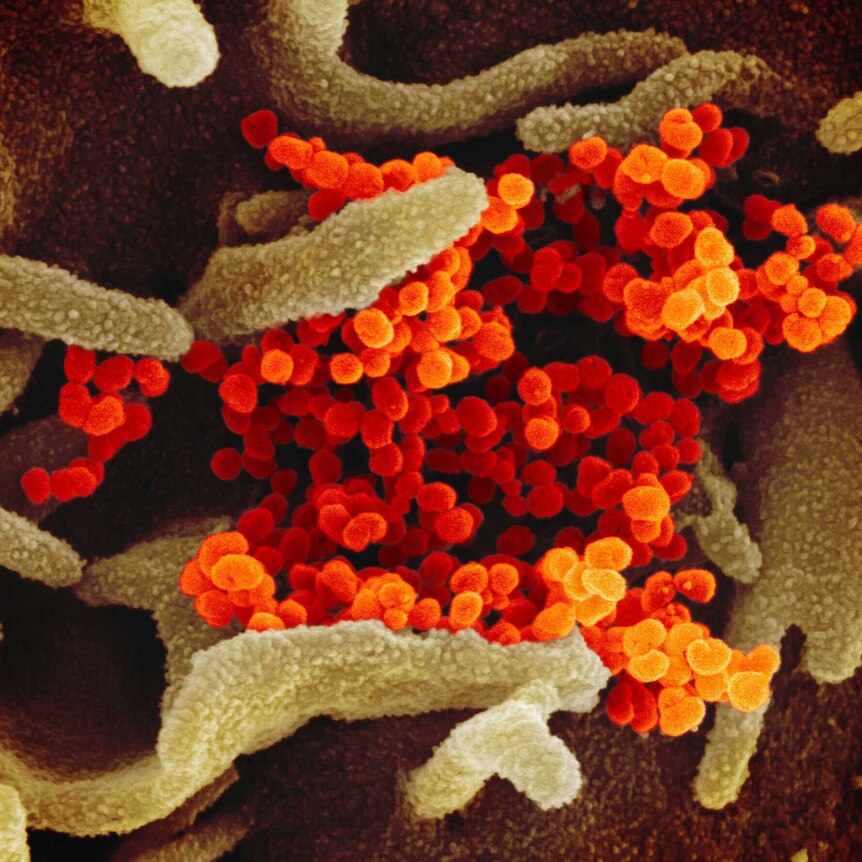 A microscopic image shows orange circular cells surrounded by long green cells.