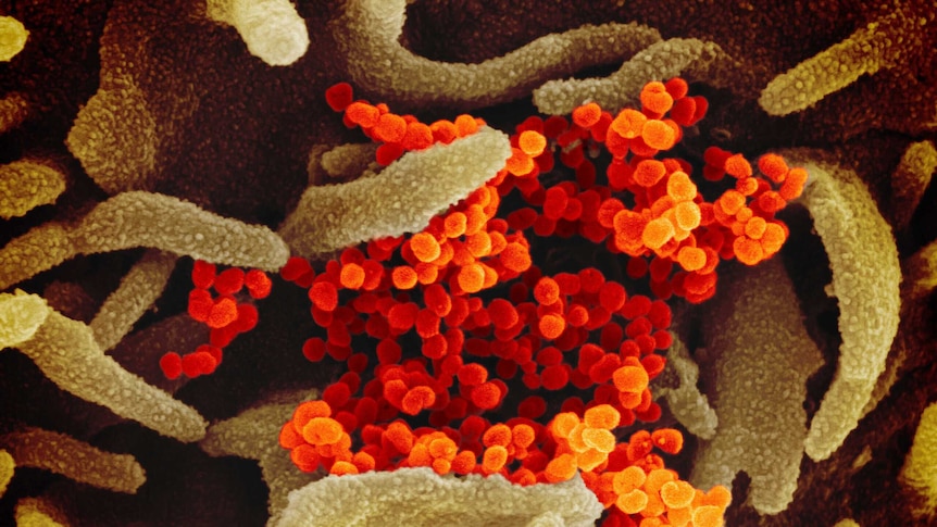 A microscopic image shows orange circular cells surrounded by long green cells.