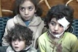 No relent: Syrian children wounded by mortar fire in Homs.