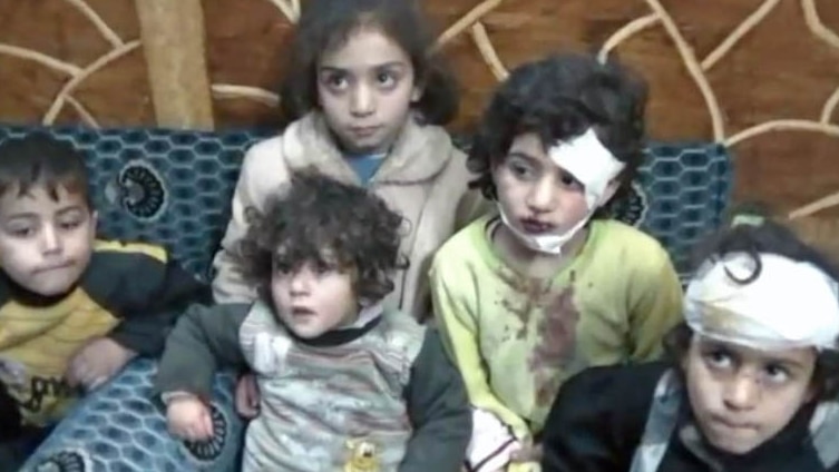 No relent: Syrian children wounded by mortar fire in Homs.