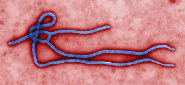 Dear world, please help save us from Ebola