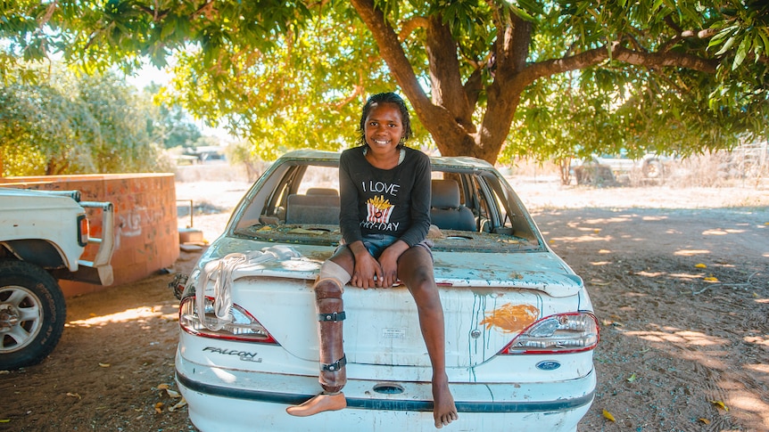 A young girl sits on the back of a car, wearing a prosthetic leg.