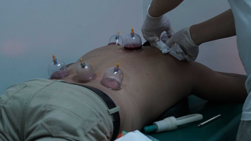 A man lays on his stomach as suction cups are stuck to his back.