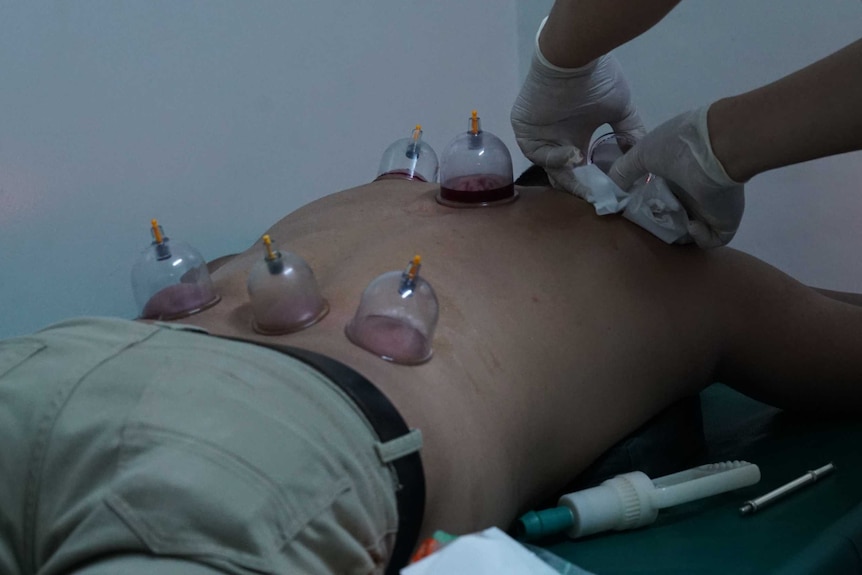 A man lays on his stomach as suction cups are stuck to his back.