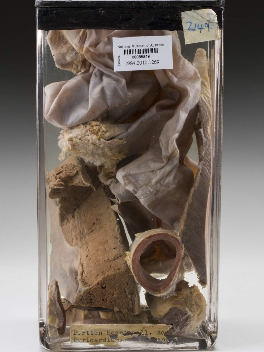 Australian Institute of Anatomy specimens – portions of heart wall, aorta and pericardium, believed to be from Phar Lap’s heart. 1932