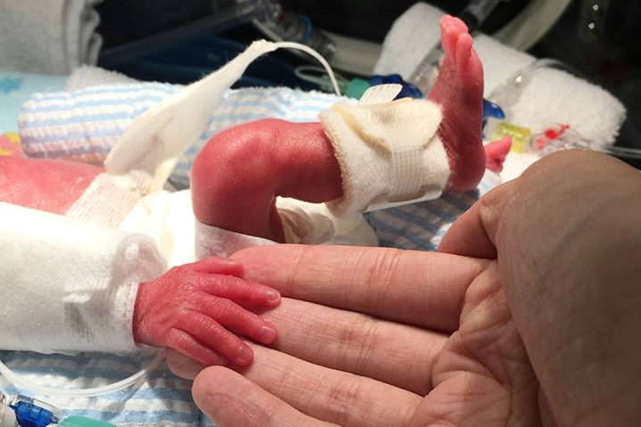 The foot and hand of a premmie baby with hand holding an adult's hand. Fingers only reach an adult's fingertips.