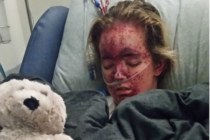 A girl in a hospital bed with a teddy bear
