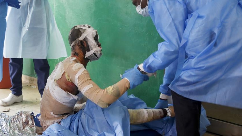 A burns victim sits on the floor wrapped in gauze and bandages as a doctor in blue surgical gown tends to his injuries 
