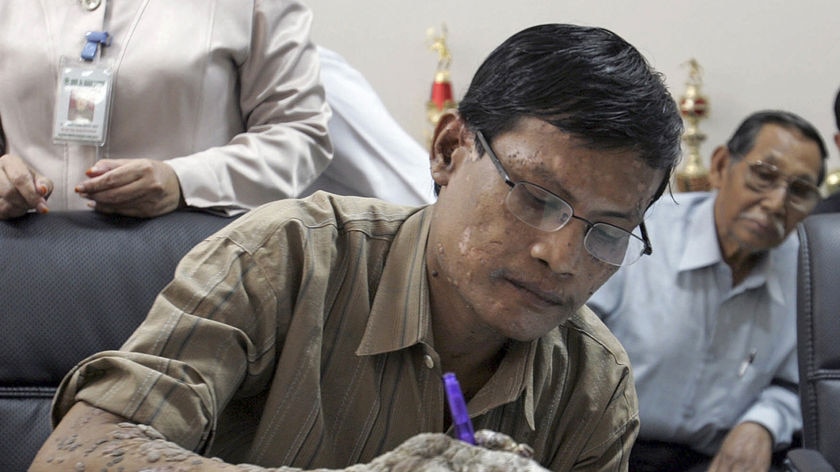 Dede, dubbed the "tree man", demonstrates holding a pen during a news conference in Bandung in August. Dede says he now needs assistance for such activities.