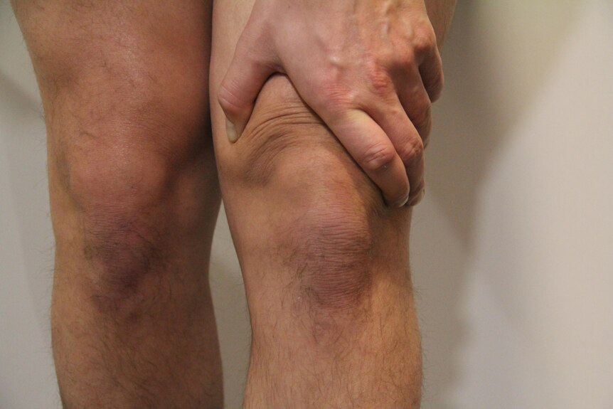 Man holds knee appearing to be in pain
