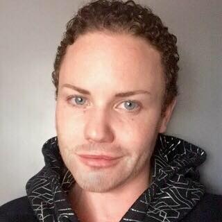 A recent photo of Jess Jones, after two years of male hormone therapy