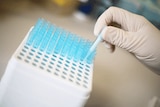 Cancer research laboratory generic image.