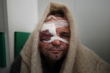 A man with bloodied bandages over his right eye, scars on his face and a blanket over his head looks directly into the camera.