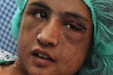 Afghan child bride Sahar Gul recovers from her wounds.