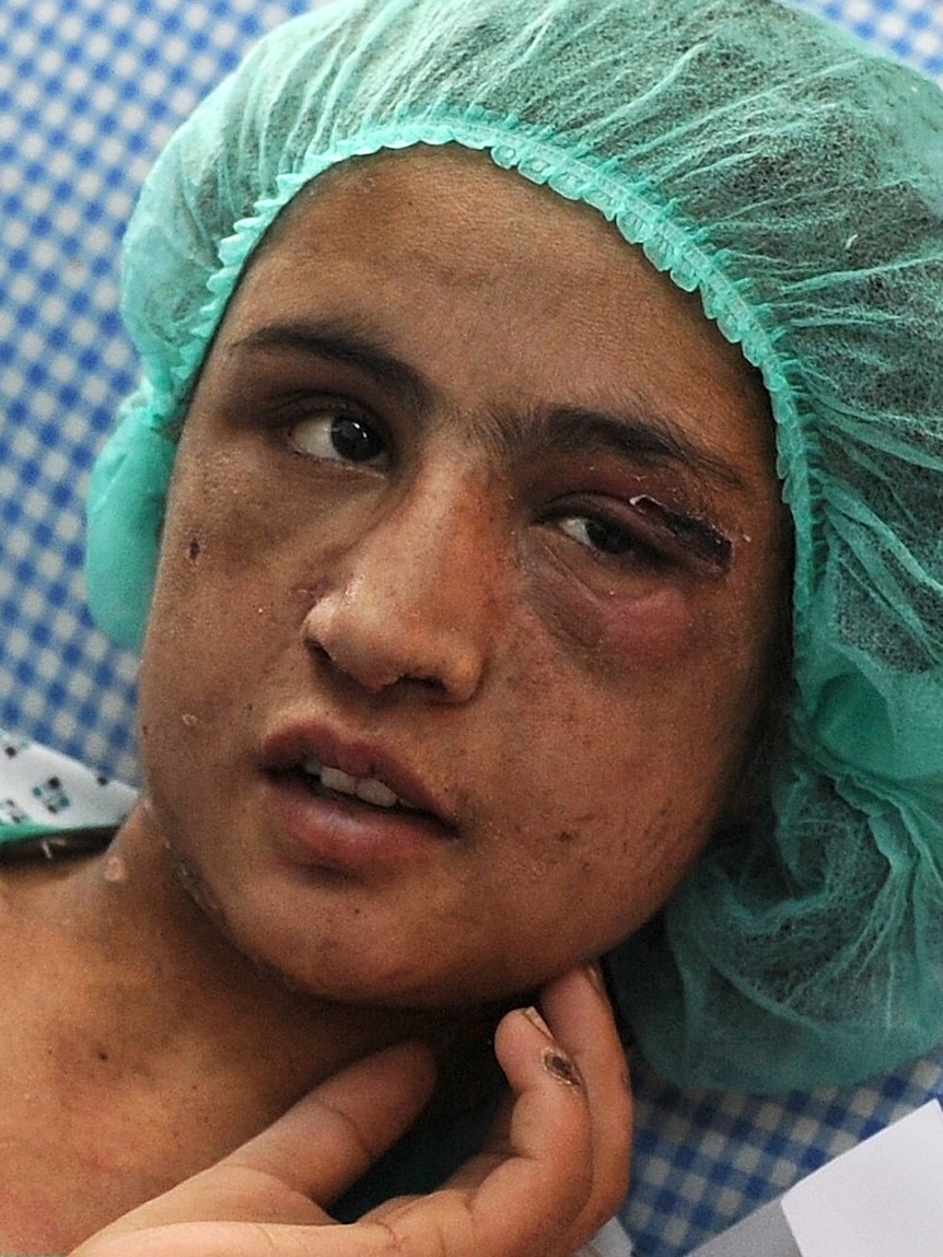 Afghan child bride Sahar Gul recovers from her wounds.