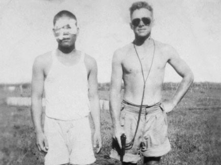 A man with bandages on his face stands next to an Australian soldier holding a gun.