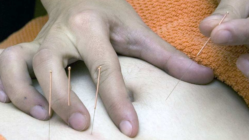 Therapist inserting a fourth acupuncture needle into a person's abdomen