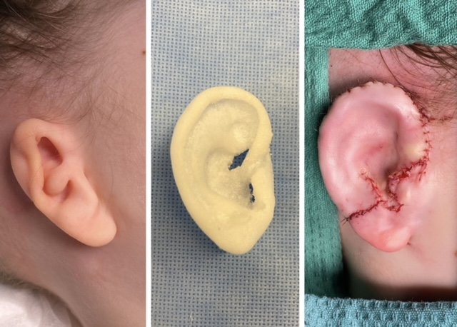 A small ear, a plastic looking ear and a full formed ear.