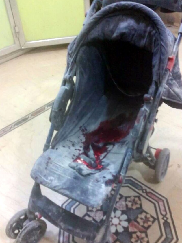 A blood-stained stroller in an Aleppo hospital