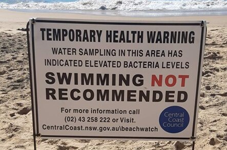 A sign saying "temporary health warning, swimming not recommended" placed on a beach on a sunny day.
