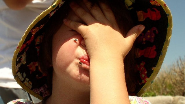 Flies on child's face