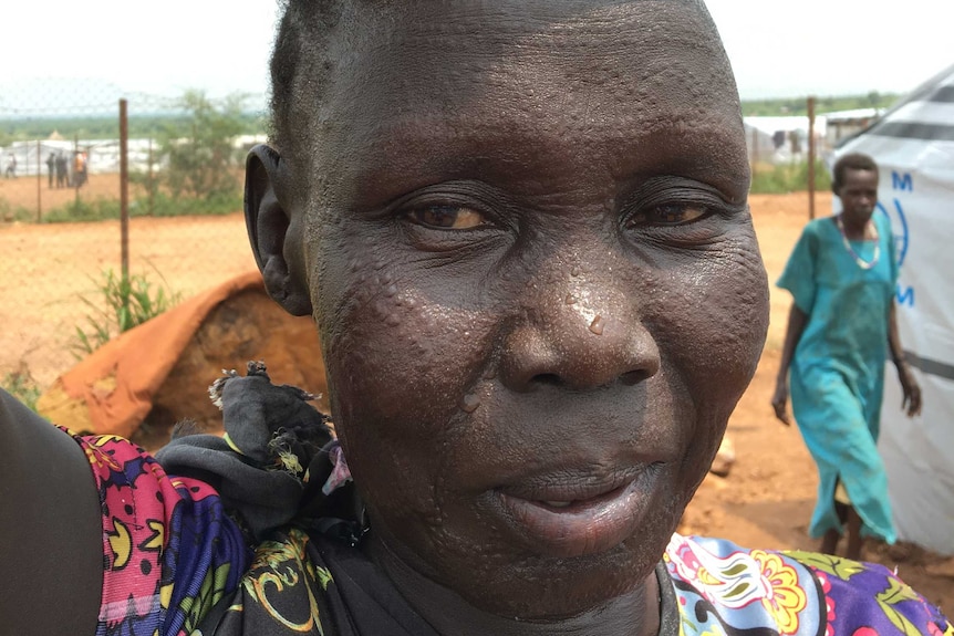 A woman with scars in a pattern on her face holds a bucket of water on her head.