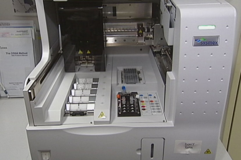 OSNA machine (one step nucleic acid amplification)