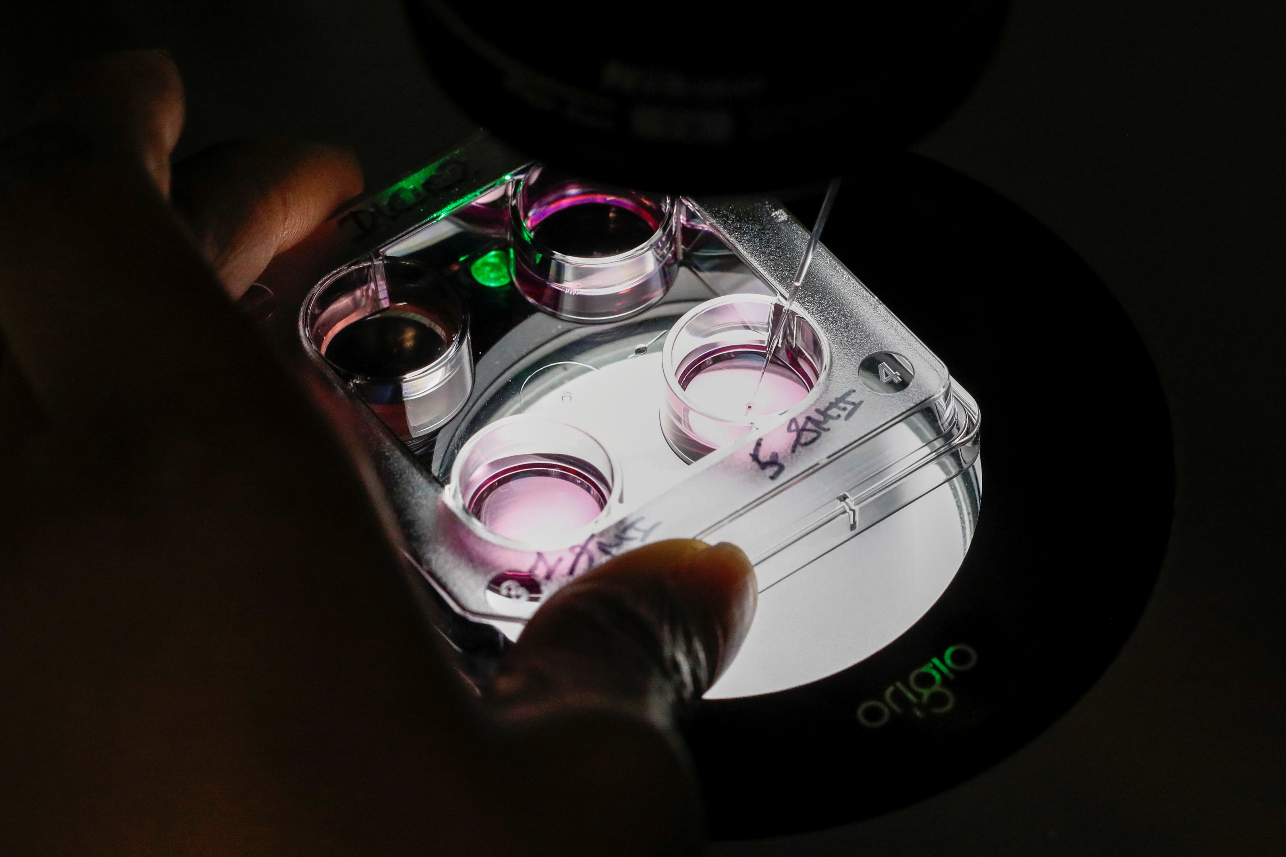 A medical technician selects eggs for an in-vitro fertilization (IVF) procedure called Intracytoplasmic Sperm Injection (ICSI).