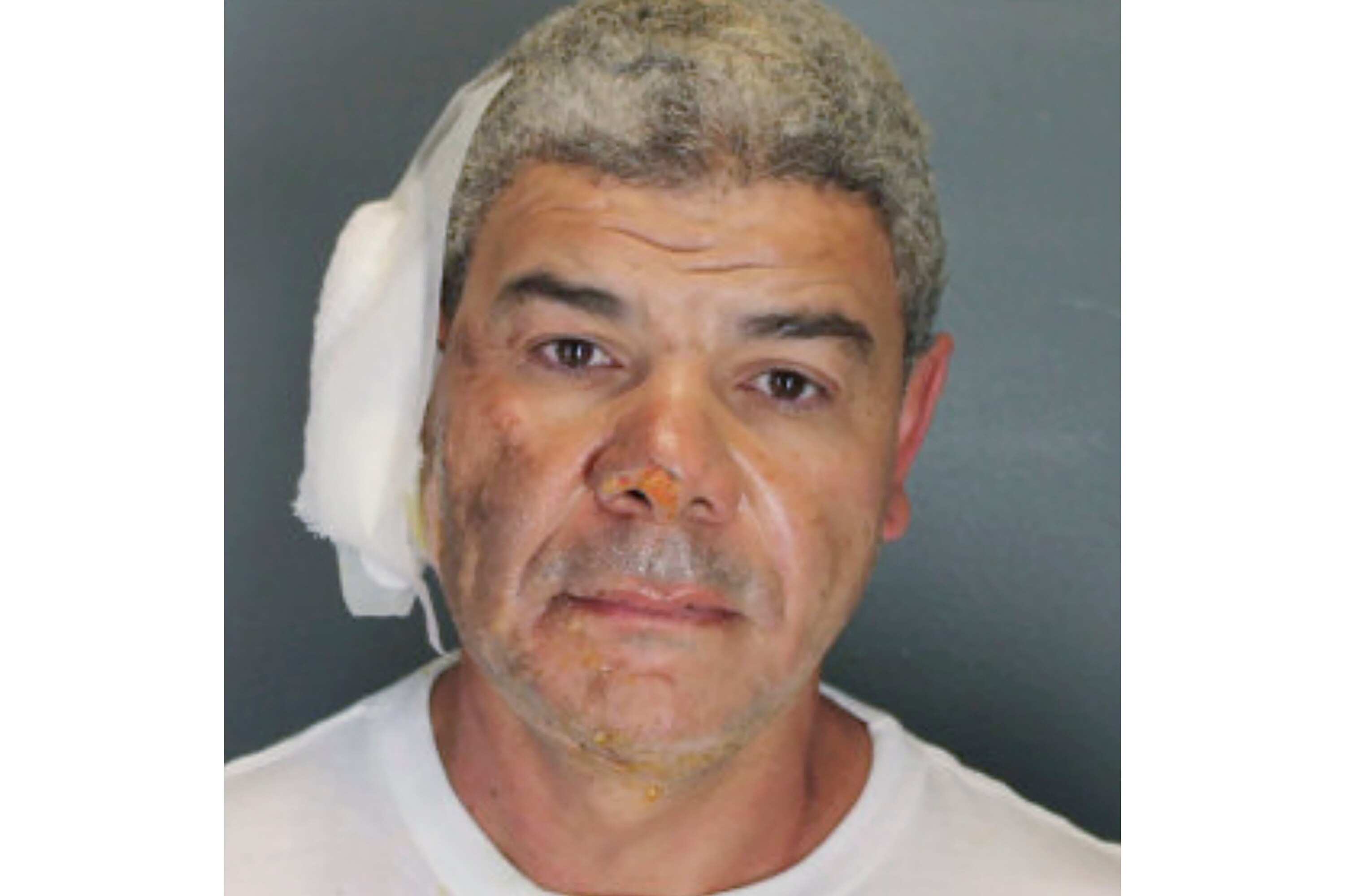 A man with greying hair and a large bandage over his right ear emotionless in a police mugshot