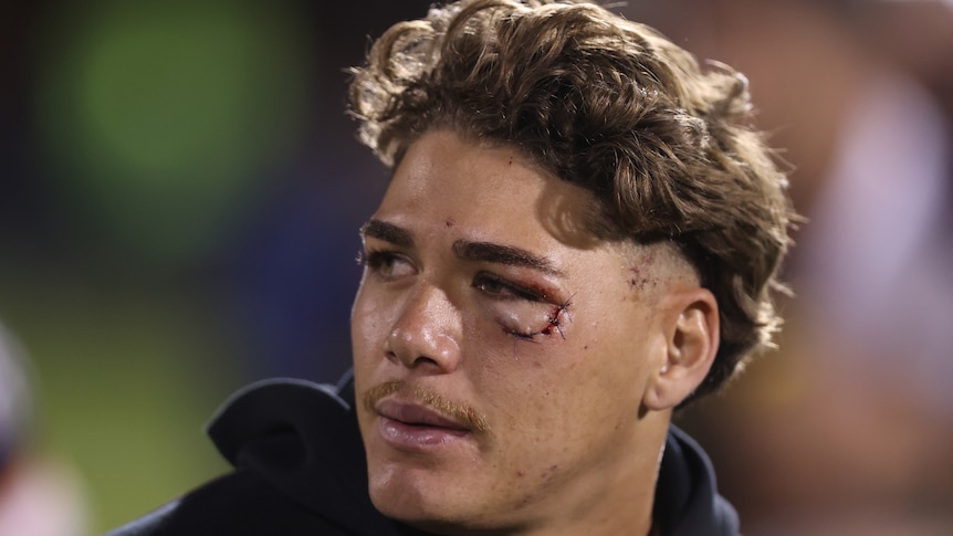 Reece Walsh looks to his right with a cut under his left eye after the Broncos' NRL loss to the Panthers.