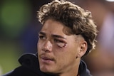 Reece Walsh looks to his right with a cut under his left eye after the Broncos' NRL loss to the Panthers.